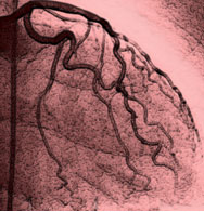 Coronary-angiography